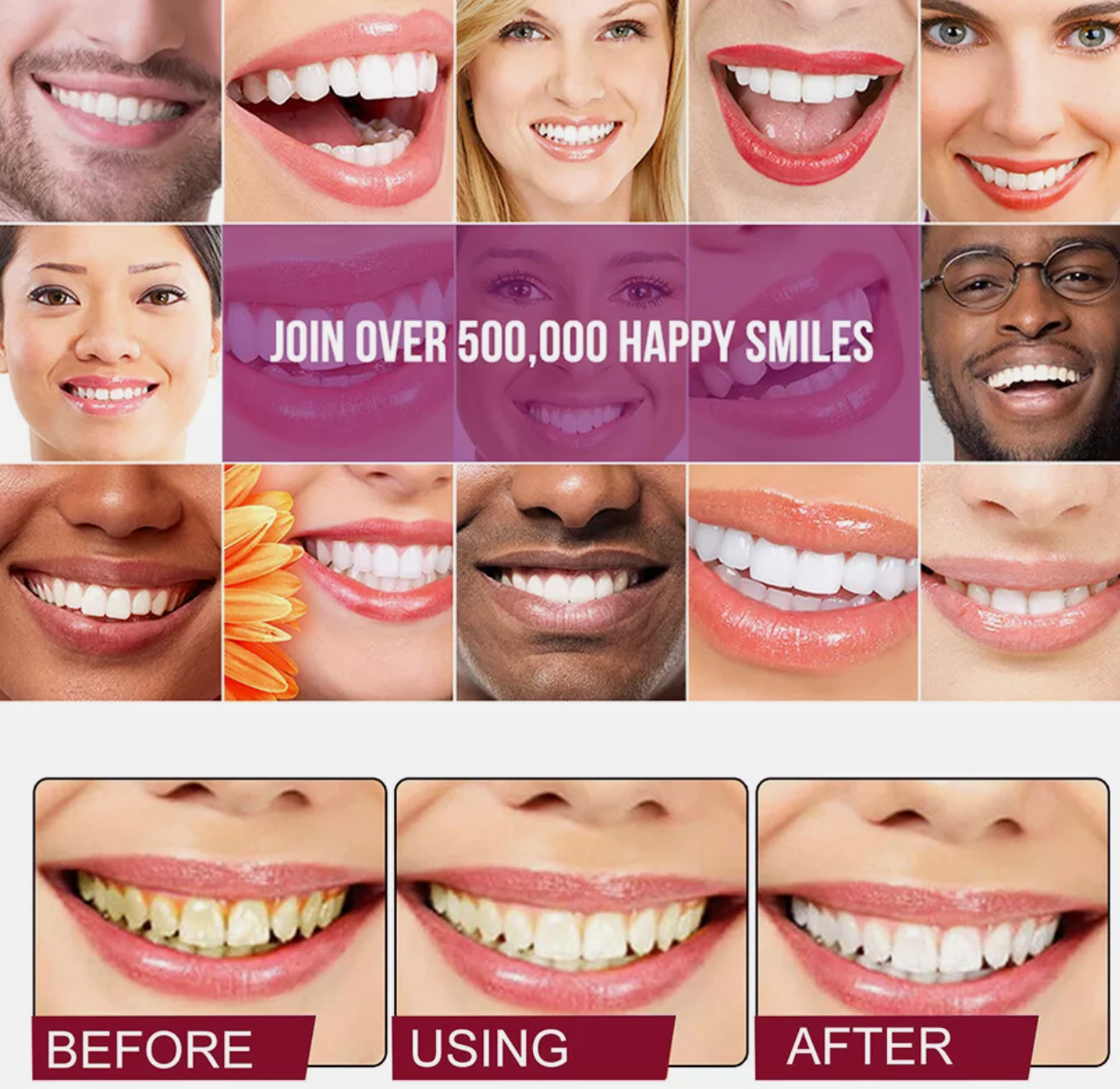SP-4 Probiotic Toothpaste Teeth Whitening Toothpaste Fresh Breath 200 Grams
