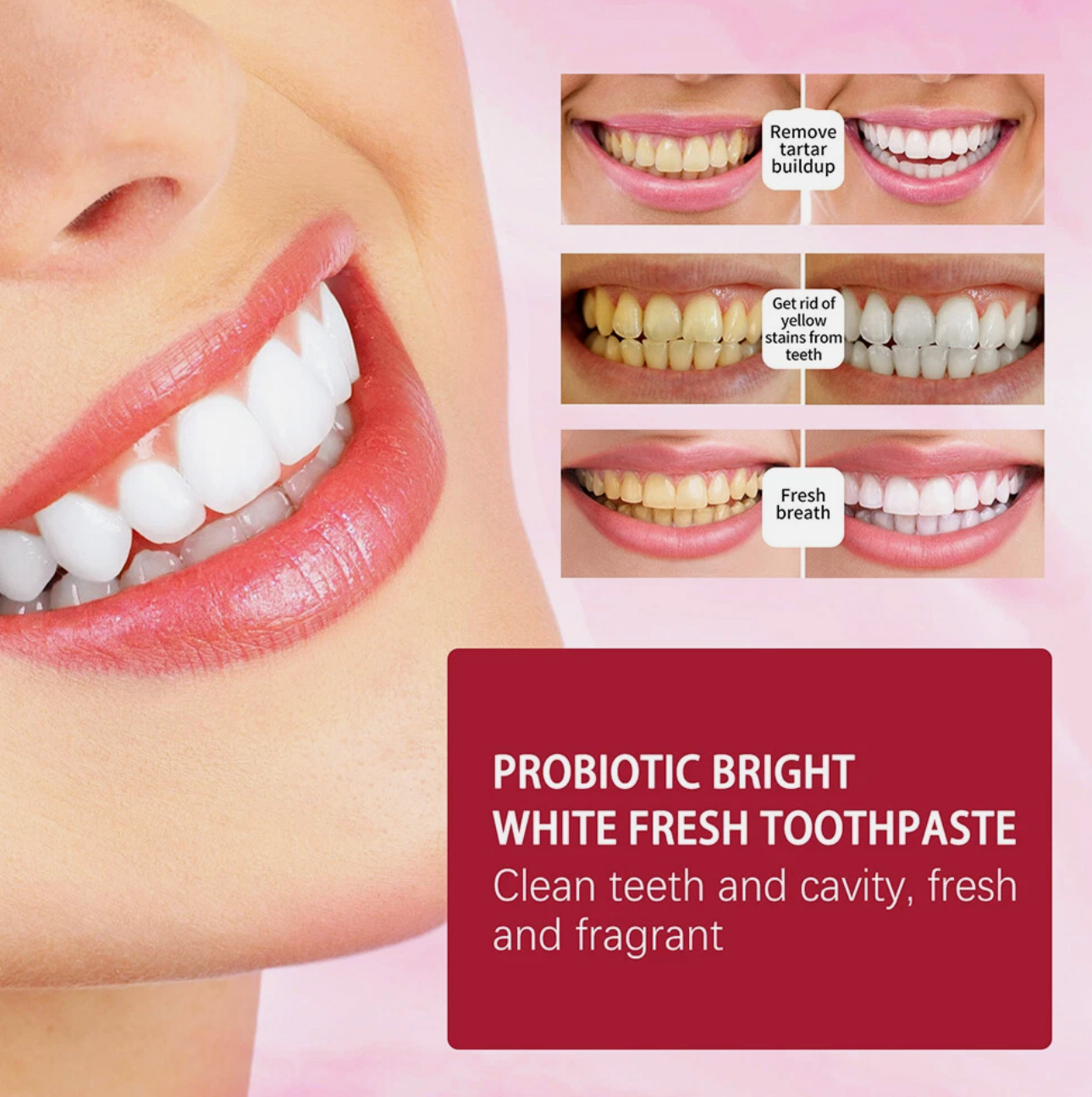 SP-4 Probiotic Toothpaste Teeth Whitening Toothpaste Fresh Breath 200 Grams